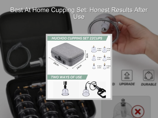 Best At Home Cupping Set: Honest Results After Use