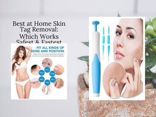 Best at Home Skin Tag Removal: Which Works Safest & Fastest