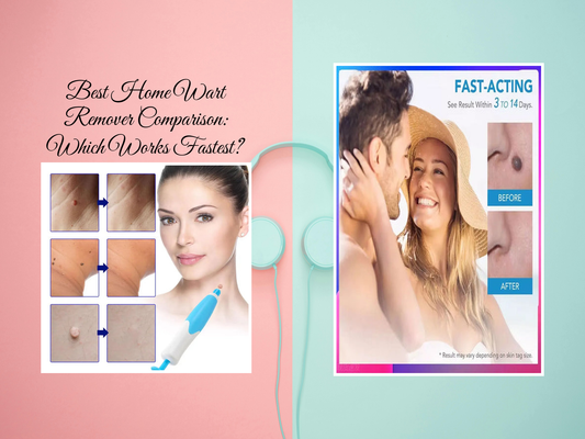 Best Home Wart Remover Comparison: Which Works Fastest?