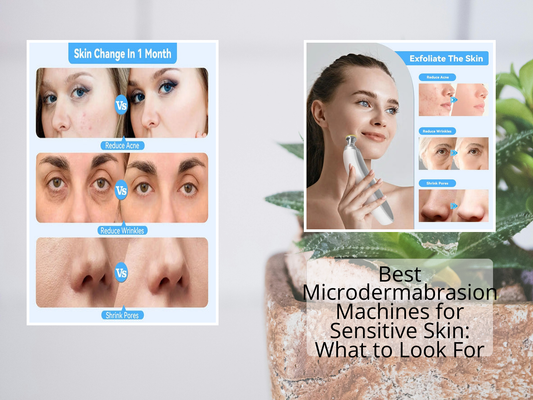 Best Microdermabrasion Machines for Sensitive Skin: What to Look For