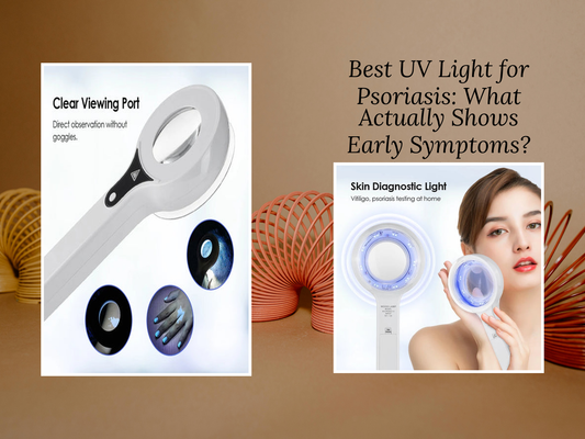 Best UV Light for Psoriasis: What Actually Shows Early Symptoms? (67 chars)