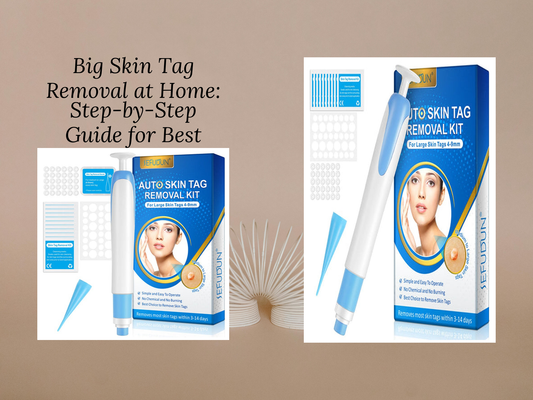Big Skin Tag Removal at Home: Step-by-Step Guide for Best Results