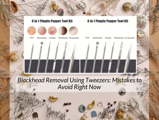 Blackhead Removal Using Tweezers: Mistakes to Avoid Right Now