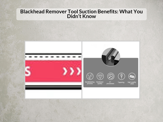 Blackhead Remover Tool Suction Benefits: What You Didn’t Know
