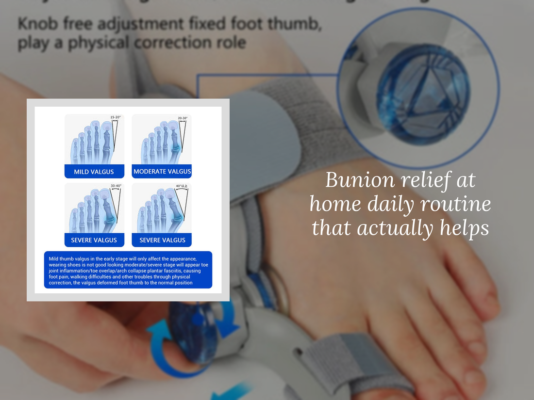 Bunion relief at home daily routine that actually helps