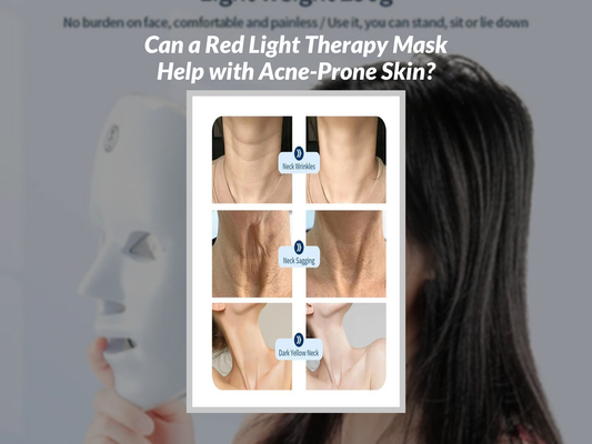 Can a Red Light Therapy Mask Help with Acne-Prone Skin?