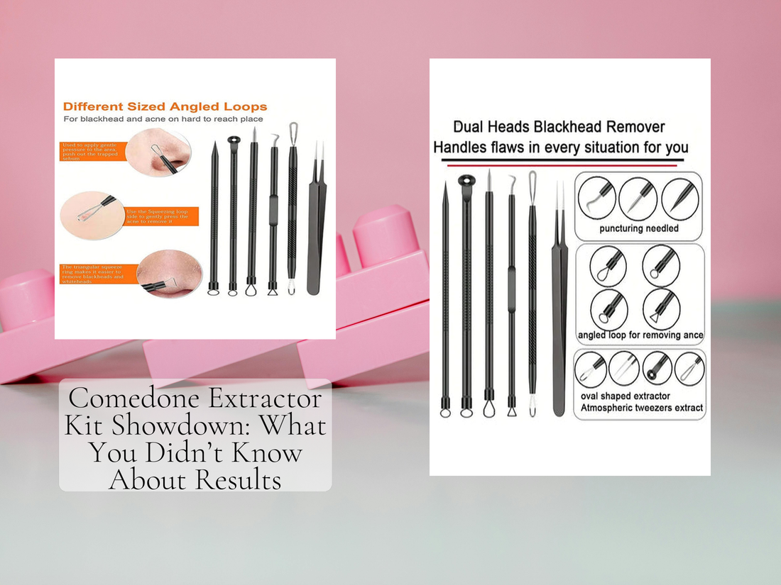 Comedone Extractor Kit Showdown: What You Didn’t Know About Results