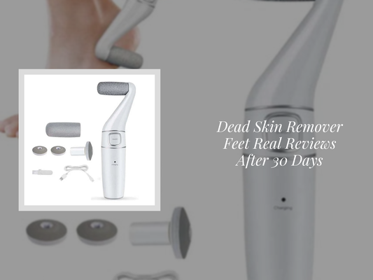 Dead Skin Remover Feet Real Reviews After 30 Days