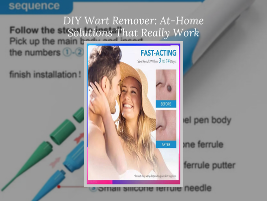 DIY Wart Remover: At-Home Solutions That Really Work