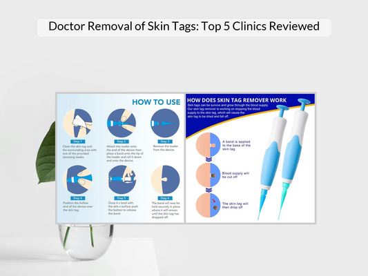 Doctor Removal of Skin Tags: Top 5 Clinics Reviewed