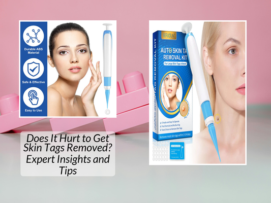 Does It Hurt to Get Skin Tags Removed? Expert Insights and Tips