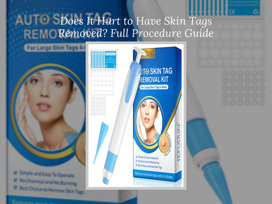 Does It Hurt to Have Skin Tags Removed? Full Procedure Guide