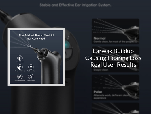 Earwax Buildup Causing Hearing Loss Real User Results