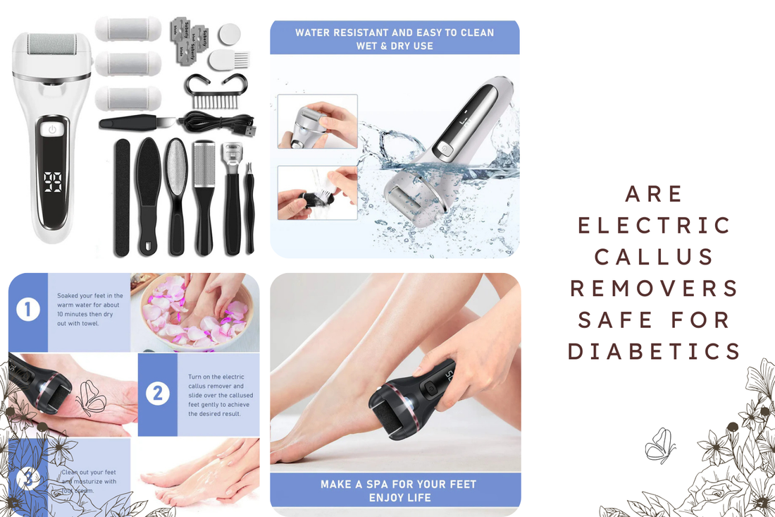 Are Electric Callus Removers Safe for Diabetics