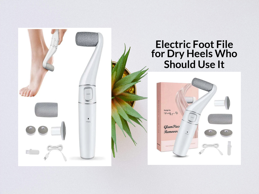 Electric Foot File for Dry Heels Who Should Use It