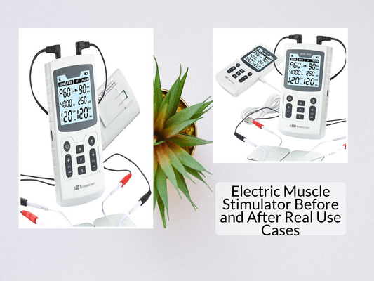 Electric Muscle Stimulator Before and After Real Use Cases