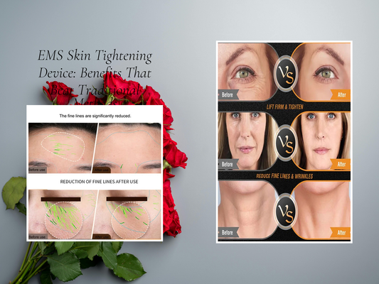 EMS Skin Tightening Device: Benefits That Beat Traditional Methods
