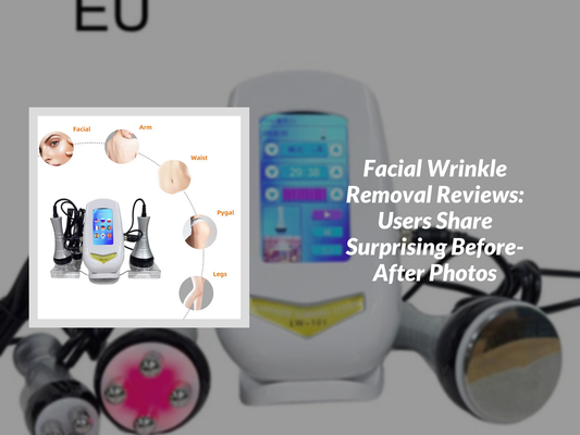 Facial Wrinkle Removal Reviews: Users Share Surprising Before-After Photos