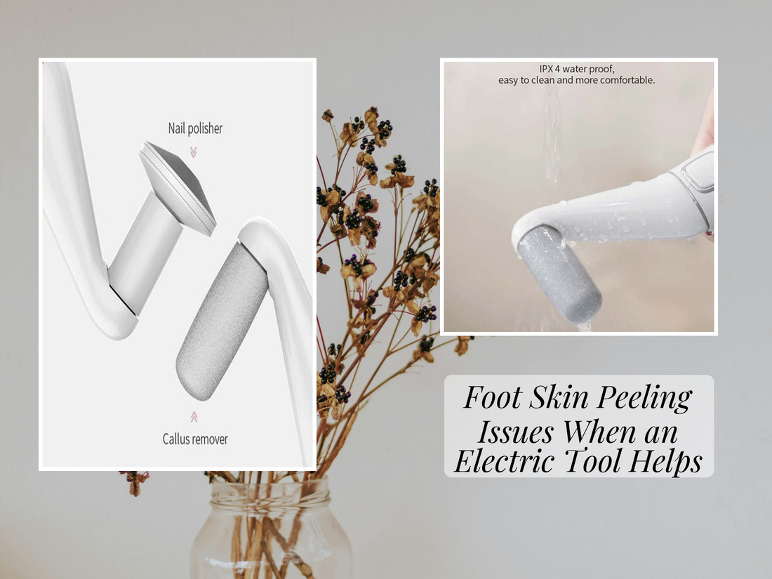 Foot Skin Peeling Issues When an Electric Tool Helps