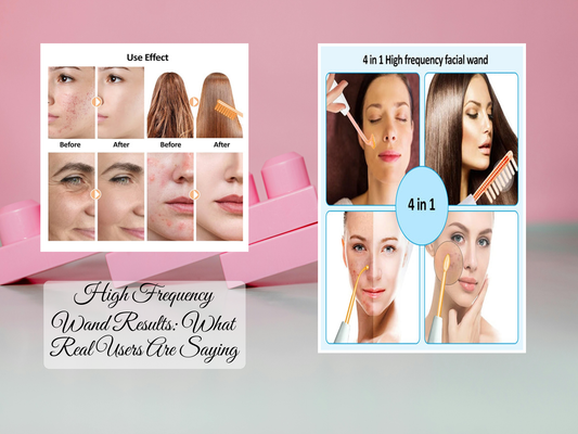 High Frequency Wand Results: What Real Users Are Saying