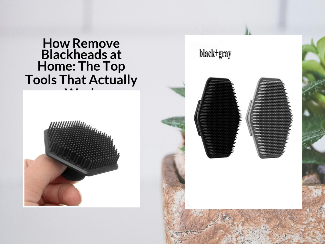 How Remove Blackheads at Home: The Top Tools That Actually Work