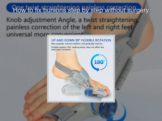 How to fix bunions step by step without surgery