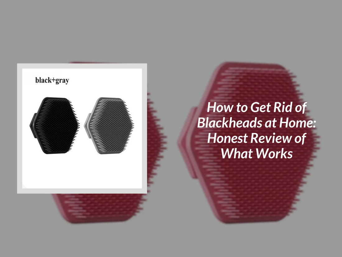 How to Get Rid of Blackheads at Home: Honest Review of What Works