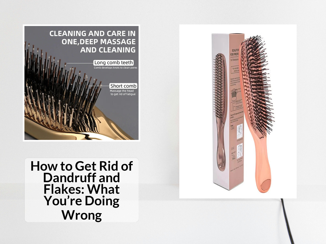 How to Get Rid of Dandruff and Flakes: What You’re Doing Wrong