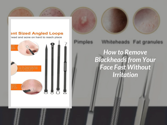 How to Remove Blackheads from Your Face Fast Without Irritation