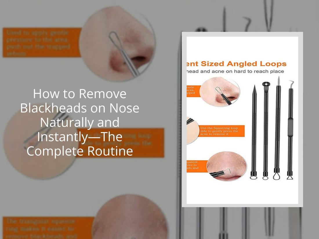 How to Remove Blackheads on Nose Naturally and Instantly—The Complete Routine