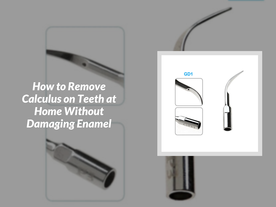 How to Remove Calculus on Teeth at Home Without Damaging Enamel