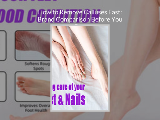 How to Remove Calluses Fast: Brand Comparison Before You Buy