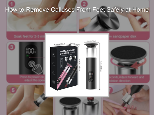 How to Remove Calluses From Feet Safely at Home