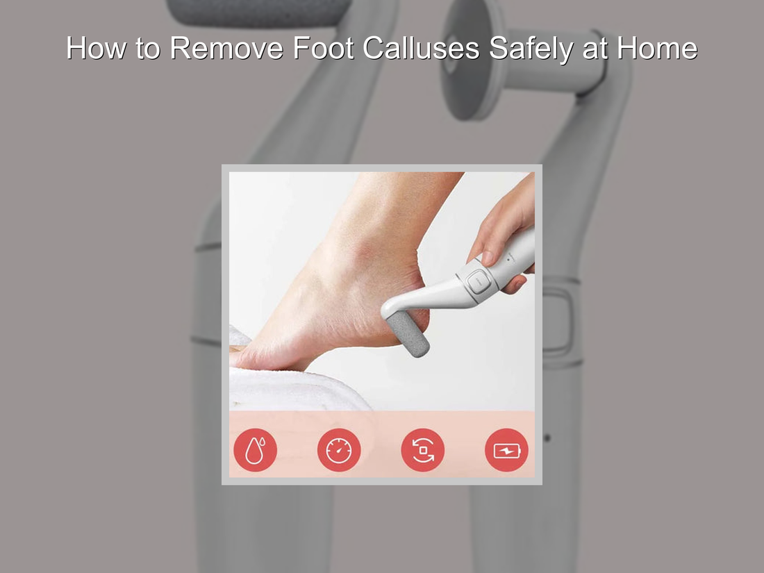 How to Remove Foot Calluses Safely at Home
