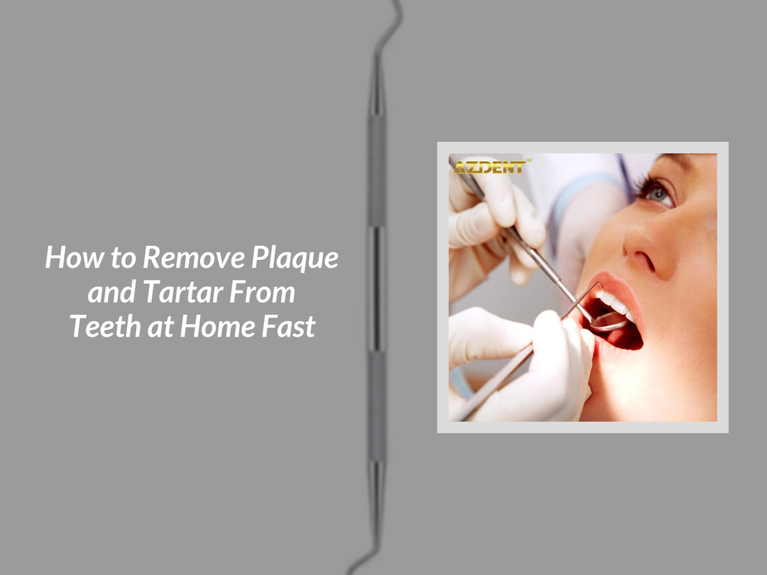 How to Remove Plaque and Tartar From Teeth at Home Fast