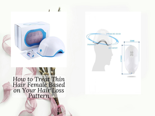 How to Treat Thin Hair Female Based on Your Hair Loss Pattern