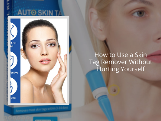 How to Use a Skin Tag Remover Without Hurting Yourself
