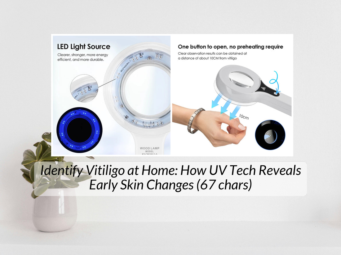 Identify Vitiligo at Home: How UV Tech Reveals Early Skin Changes (67 chars)