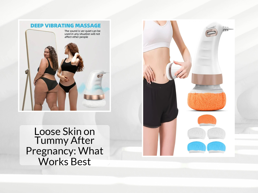 Loose Skin on Tummy After Pregnancy: What Works Best