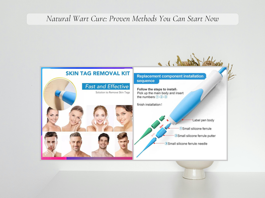 Natural Wart Cure: Proven Methods You Can Start Now