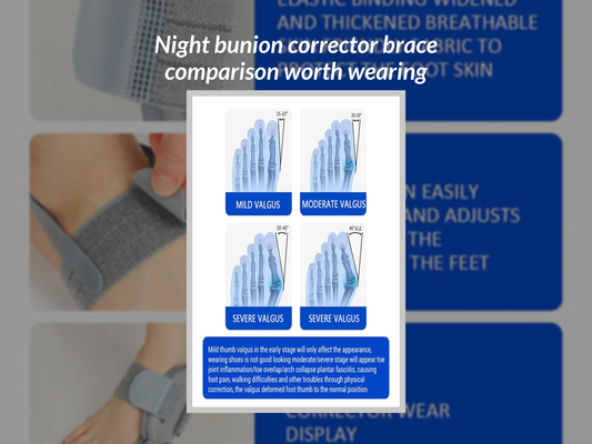 Night bunion corrector brace comparison worth wearing