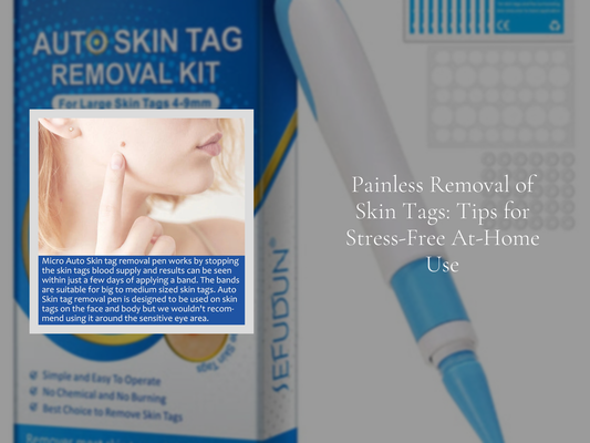 Painless Removal of Skin Tags: Tips for Stress-Free At-Home Use