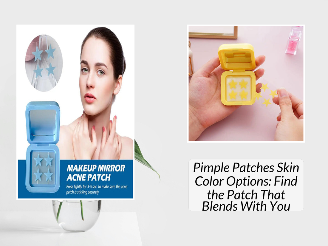 Pimple Patches Skin Color Options: Find the Patch That Blends With You