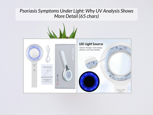 Psoriasis Symptoms Under Light: Why UV Analysis Shows More Detail (65 chars)