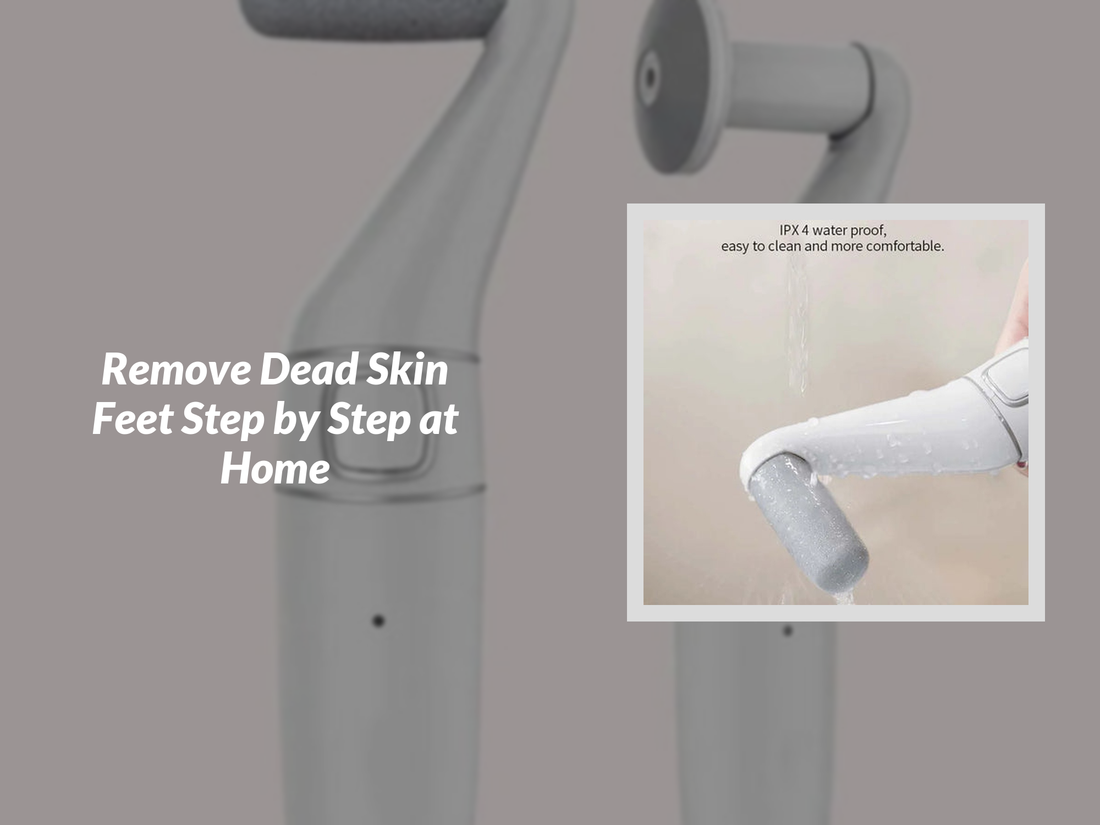 Remove Dead Skin Feet Step by Step at Home
