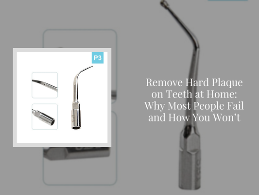 Remove Hard Plaque on Teeth at Home: Why Most People Fail and How You Won’t