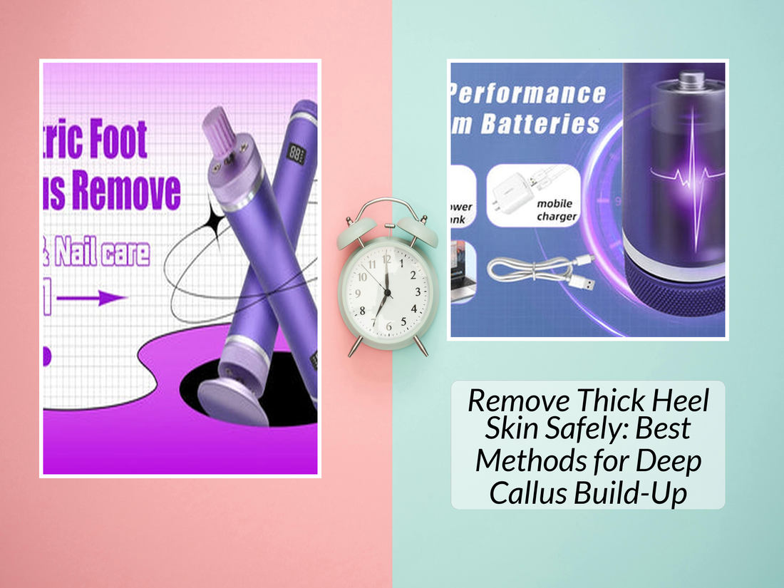 Remove Thick Heel Skin Safely: Best Methods for Deep Callus Build-Up