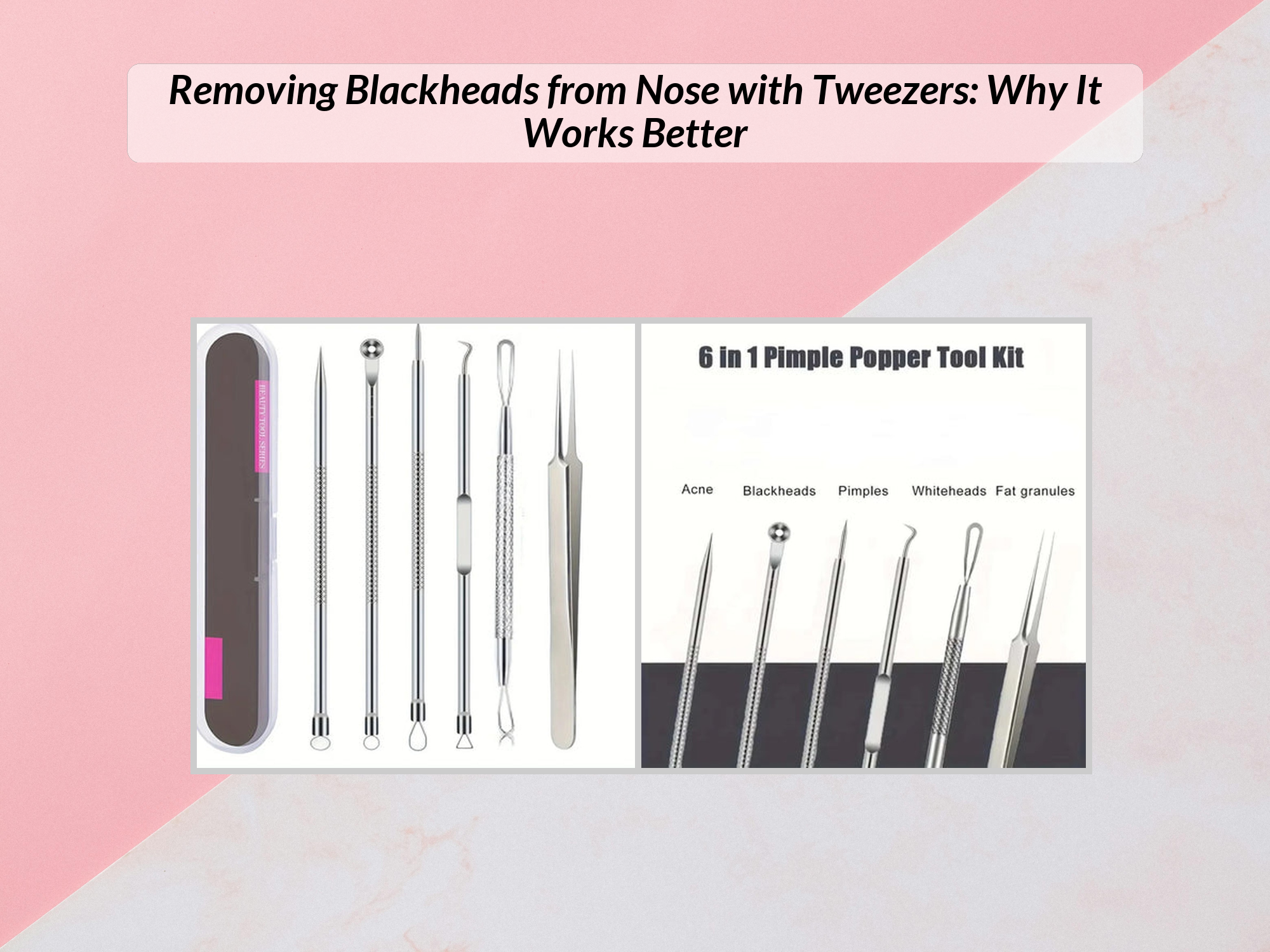 Removing Blackheads from Nose with Tweezers: Precise Tips – KentDO ...