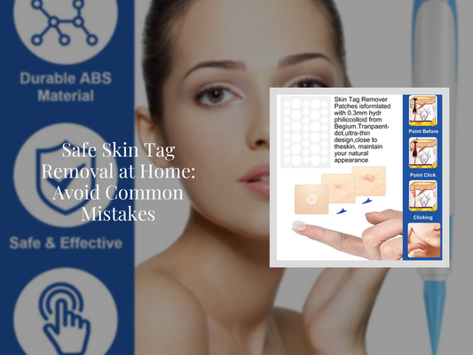 Safe Skin Tag Removal at Home: Avoid Common Mistakes