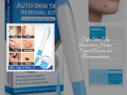 Safe Skin Tag Removal at Home: Expert Reviews and Recommendations